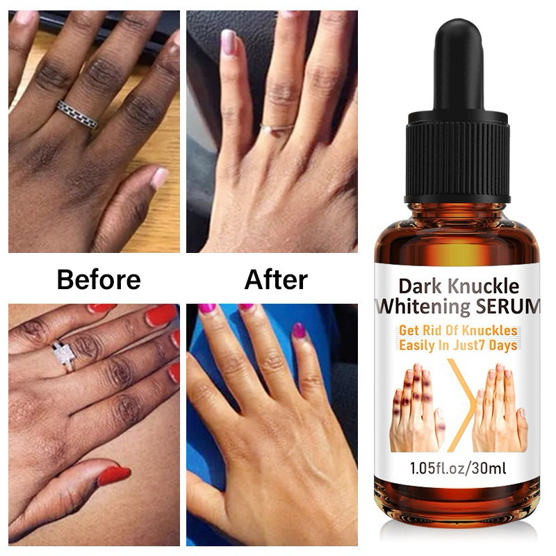 Dark knuckles Whitening Serum 30ml